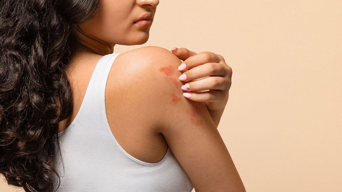 Why Does Skincare Sting on Application? Is It Your Skin or the Product?